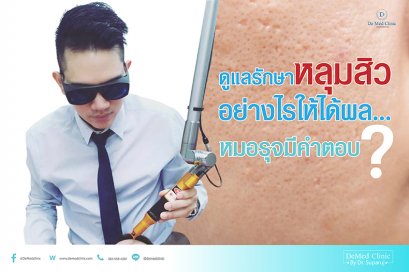 ดูแลรักษาหลุมสิวอย่างไรให้ได้ผล...หมอรุจมีคำตอบ?