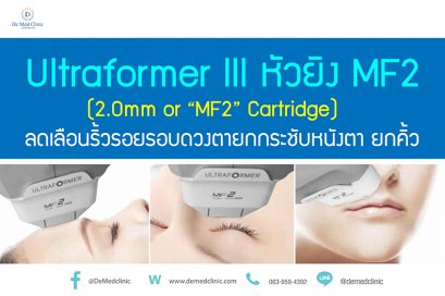 Ultraformer lll หัวยิง MF2 (2.0mm or “MF2” Cartridge) ลดเลือนริ้วรอยรอบดวงตายกกระชับหนังตา ยกคิ้ว