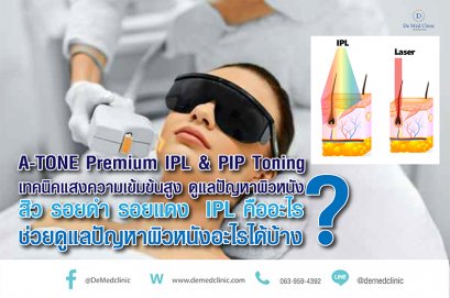 A-TONE Premium IPL & PIP Toning เทคนิคแสงความเข้มข้นสูง ดูแลปัญหาผิวหนัง สิว รอยดำ รอยแดง  IPL คืออะไร ช่วยดูแลปัญหาผิวหนังอะไรได้บ้าง?