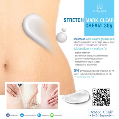 STRETCH MARK Clear CREAM 30 g. ครีมบำรุงผิว ลดรอยแตกลายสูตรเข้มข้นพิเศษ