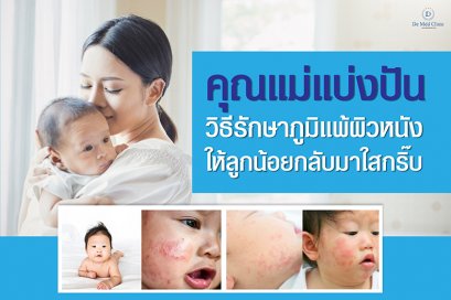 คุณแม่แบ่งปัน วิธีรักษาภูมิแพ้ผิวหนังให้ลูกน้อยกลับมาใสกริ๊บ