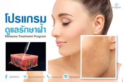 โปรแกรมดูแลรักษาฝ้า Melasma Treatment Program