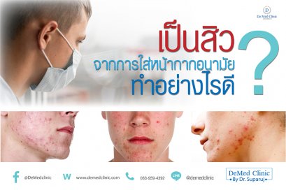 เป็นสิวจากการใส่หน้ากากอนามัยทำอย่างไรดี