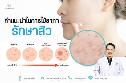คำแนะนำในการใช้ยาทารักษาสิว ที่หมอรุจ อยากแนะนำ