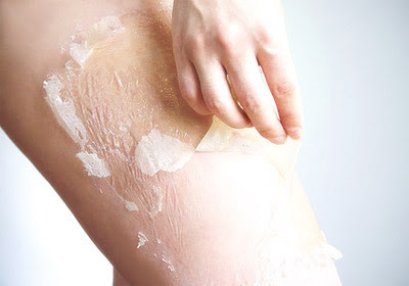 ดูแลรักษา รอยแตกลาย ผิวแตกลาย ด้วย Premium PRFM Platelet-Rich Fibrin Matrix Cell Therapy