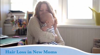 ภาวะผมร่วงหลังมีบุตรสามารถเกิดขึ้นได้ที่คุณแม่ควรรู้?