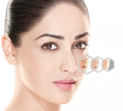 Premium Fractional Laser Plus Program 