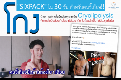โกง "SIXPACK" ใน 30 วัน สำหรับคนขี้เกียจ!! ด้วยการสลายไขมันด้วยความเย็น (Cryolipolysis) ที่ช่วยให้คุณรักษารูปร่างโดย ไม่มีบาดแผล ไม่เจ็บ ไม่ต้องพักฟื้น