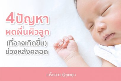 4 ปัญหาผดผื่นผิวลูก (ที่อาจเกิดขึ้น) ช่วงหลังคลอด