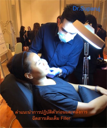 คำแนะนำการปฏิบัติตัว ก่อน และ หลัง รับการฉีดสารเติมเต็ม Filler 