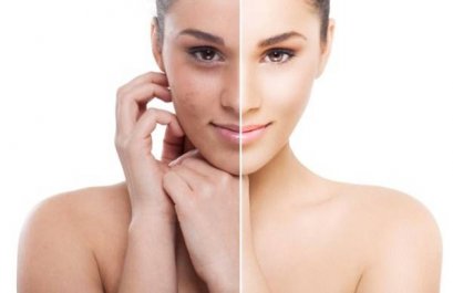 ดูแลผิวอย่างไรดี หลังเล่นน้ำสงกรานต์ 