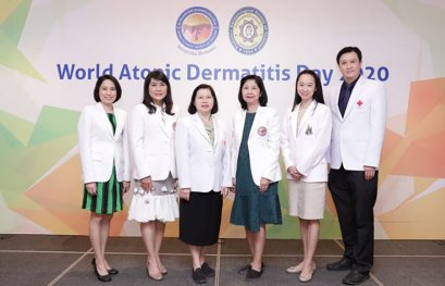 แพทย์ชี้โรคผื่นภูมิแพ้ผิวหนัง เป็นโรคใกล้ตัวที่ไม่ควรมองข้าม