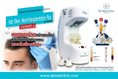 ปลูกผมด้วยเทคนิคพิเศษล่าสุด Hair Stem MicroTransplantation Plus (HSMT+)
