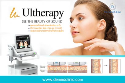 Ultherapy เทคโนโลยีการรักษาที่ได้รับการรับรองจากองค์การอาหารและยาว่า สามารถสามารถ ยกกระชับใต้คาง ลดเหนียง และกระตุ้นการสร้างคอลลาเจนใหม่ซึ่งทำให้ผิวกระชับและยกกระชับขึ้น