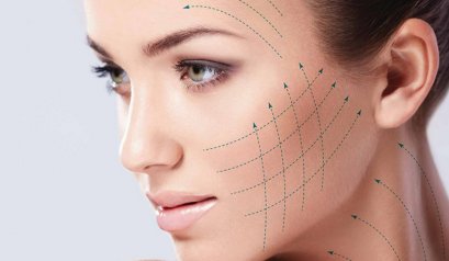 การร้อยไหม (#Thread lifting) ปลอดภัยหรือไม่ ???