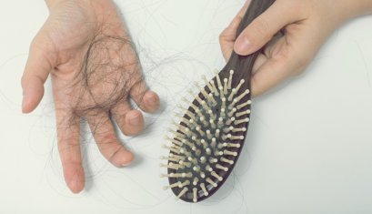 ภาวะผมร่วง Telogen effluvium