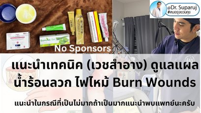 แนะนำเทคนิค (เวชสำอาง) ดูแลแผลน้ำร้อนลวก ไฟไหม้ Burn Wounds