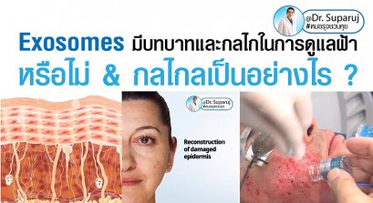 Exosomes มีบทบาทและกลไกในการดูแลฝ้า หรือไม่ & กลไกลเป็นอย่างไร ?