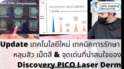 จะตรวจสอบว่าเลเซอร์ Picosecond Laser ที่ได้รับการรักษาอยู่เป็นเครื่องแท้หรือไม่ จะตรวจสอบได้อย่างไร ?