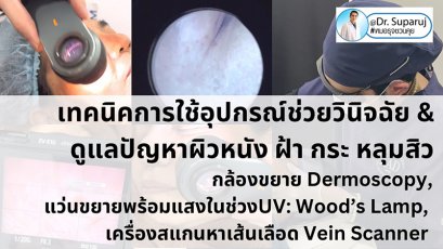 เทคนิคการใช้อุปกรณ์ช่วยวินิจฉัย & ดูแลปัญหาผิวหนัง ฝ้า กระ หลุมสิว: กล้องขยาย Dermoscopy, แว่นขยายพร้อมแสงในช่วงUV: Wood’s Lamp, เครื่องสแกนหาเส้นเลือด Vein Scanner