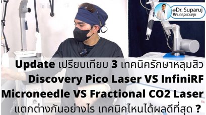 Update เปรียบเทียบ 3 เทคนิครักษาหลุมสิว Discovery Pico Laser VS InfiniRF Microneedle VS Fractional CO2 Laser แตกต่างกันอย่างไร เทคนิคไหนได้ผลดีที่สุด ?