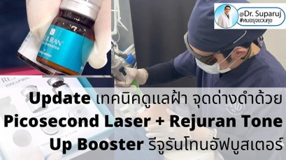 Update เทคนิคดูแลฝ้า จุดด่างดำด้วย Picosecond Laser + Rejuran Tone Up Booster รีจูรันโทนอัฟบูสเตอร์