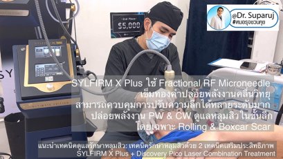 แนะนำเทคนิคดูแลรักษาหลุมสิว: เทคนิครักษาหลุมสิวด้วย 2 เทคนิคเสริมประสิทธิภาพ SYLFIRM X Plus + Discovery Pico Laser Combination Treatment