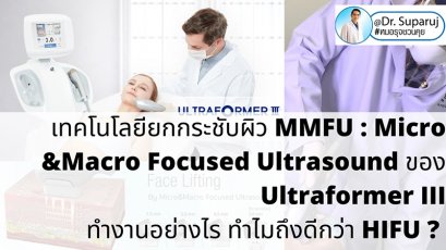 เทคโนโลยียกกระชับผิว MMFU : Micro &Macro Focused Ultrasound ของ Ultraformer III ทำงานอย่างไร ทำไมถึงดีกว่า HIFU ?