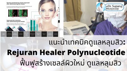 แนะนำเทคนิครักษาหลุมสิว: Rejuran Healer Polynucleotide รีจูรัน ดูแลหลุมสิว ฟื้นฟูสร้างเซลล์ผิวใหม่