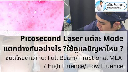 แนะนำเทคนิคดูแลหลุมสิว: Picosecond Laser แต่ละ Mode แตกต่างกันอย่างไร ?  ใช้ดูแลปัญหาไหน ชนิดไหนดีกว่ากัน: Full Beam/ Fractional MLA ?/ High Fluence/ Low Fluence