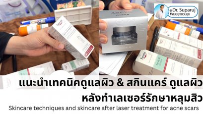 แนะนำเทคนิคดูแลผิว & สกินแคร์ ดูแลผิวหลังทำเลเซอร์รักษาหลุมสิว( Skincare techniques and skincare after laser treatment for acne scars)