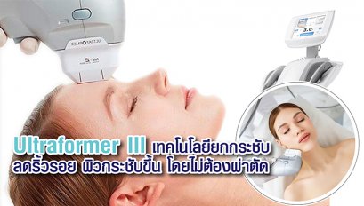 Ultraformer III เทคโนโลยียกกระชับ ลดริ้วรอย ผิวกระชับขึ้น โดยไม่ต้องผ่าตัด