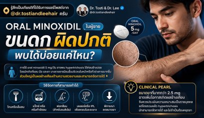 รู้สึกเป็นเกียรติที่ได้รับการแชร์โพสต์จาก @dr.tostiandleehair ครับ