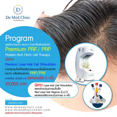 ดูแลรักษาผมร่วง ผมบาง ด้วยเกล็ดเลือดเข้มข้น Premium PRF / PRP Platelet-Rich Fibrin Cell Therapy พิเศษ Premium Laser Hair Cell Stimulation