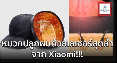 Unbox Xiaomi Cosbeauty LLLT Cap มาเปิดกล่องหมวกเลเซอร์สีแดงรักษาผมบางของ Xiaomiกันครับ