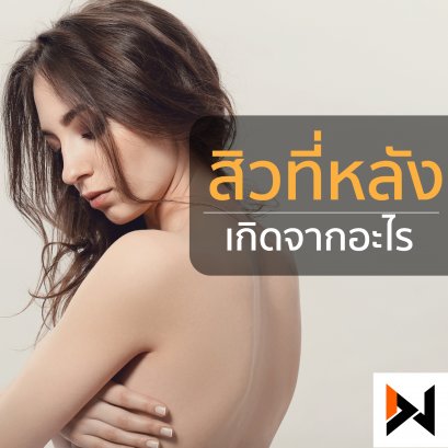 สิวที่หลังเกิดจาก