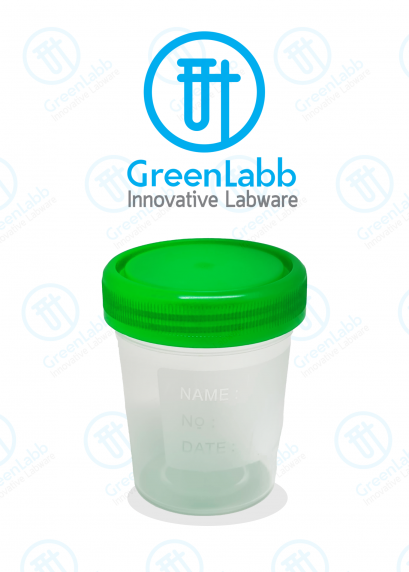 Urine Cup 60 ml, Sterile