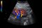 Ultrasound - Hisense HD42