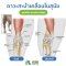 ภาวะลูกสะบ้าเคลื่อน ( Patella Luxation ) ในสุนัข - รพส.เศรษฐกิจสัตวแพทย์