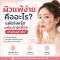 ผิวแพ้ง่าย คืออะไร? แพ้ครีมหรือแค่ระคายเคือง ต่างกันอย่างไร
