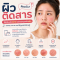 ผิวติดสารคืออะไร