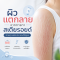 ผิวแตกลายจากครีมที่แอบผสมยาสเตอรอยด์