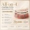 All-on-4 Full-Arch Dental Implants with 12 Fixed Teeth
