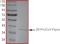 SARS-CoV-2 PLpro/Papain-Like Protease-His Recombinant Protein