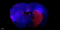 TMR (red) Tunel Cell Apoptosis Detection Kit