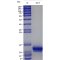 Recombinant Rat IL-2 Protein (His-tag)