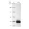 Recombinant Human IL-4 Protein (His-tag)