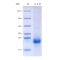 Recombinant Mouse IL-4 Protein (His-tag)