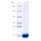 Recombinant Human IL-8 Protein (His-tag)