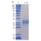 Recombinant Mouse IL-9 Protein (His-tag)